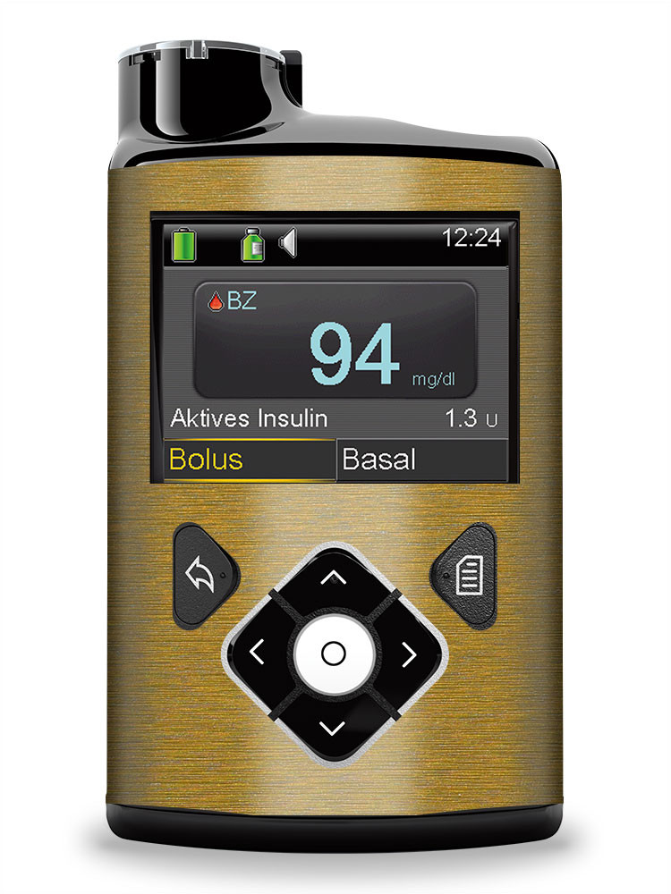 Aufkleber Für Medtronic Minimed Insulinpumpe – Gebürstet Graphit Metallic, Made In Germany, Hohe Passgenauigkeit